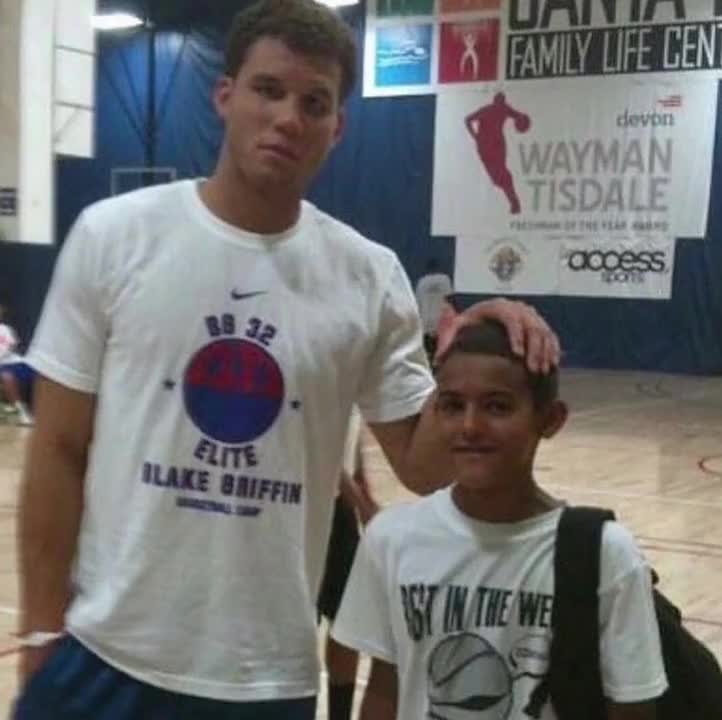 视野缺口 视野缺口